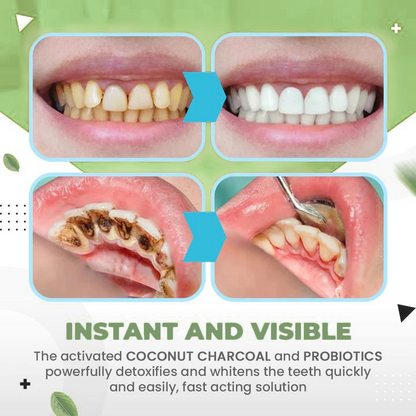 🔥TLOPA™ Ampullás fogkrém, A fogkő és a lepedékbaktériumok eltávolítása és különböző szájüregi problémák megszüntetése